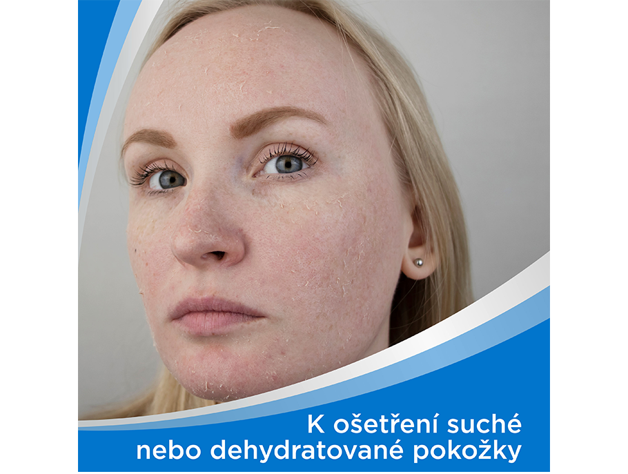 Bepanthen krém ošetřuje popraskanou pokožku